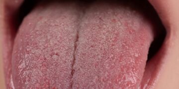 Kiek vidutiniškai yra ilgas žmogaus liežuvis?