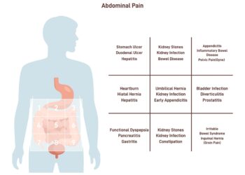 Osteoartrito požymiai ir simptomai pagal lokalizaciją