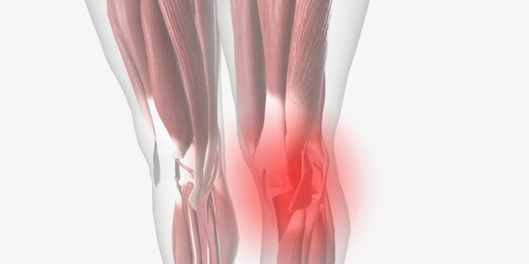 Alkūnės sumušimas