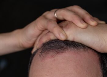 Šviesa santykiuose: Psoriazė ir intymumas