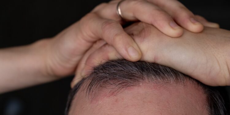 Šviesa santykiuose: Psoriazė ir intymumas