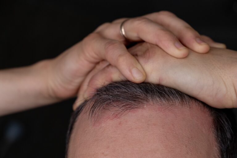 Šviesa santykiuose: Psoriazė ir intymumas