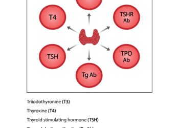 Ar reikia gydyti besimptomę Krono ligą?