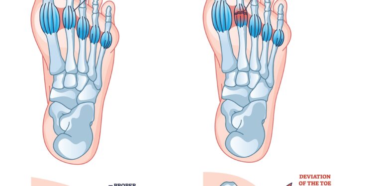 Kodėl vaikštant ar bėgant skauda blauzdas?