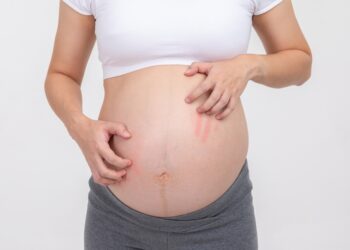 Ar niežtinčios krūtys gali būti vėžio požymis?