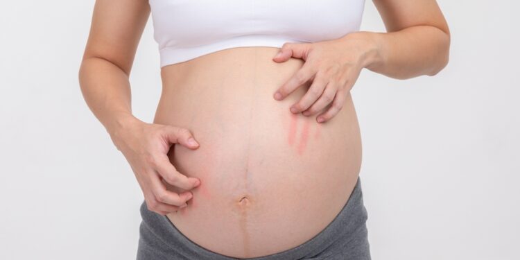 Ar niežtinčios krūtys gali būti vėžio požymis?