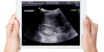 Ar inkstų ląstelių karcinomą galima aptikti ultragarsu?