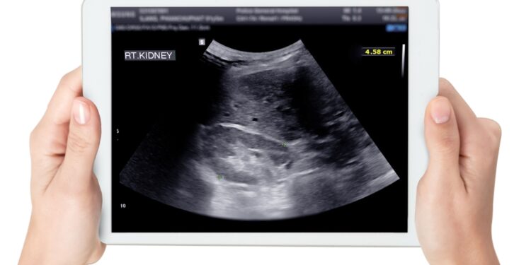 Ar inkstų ląstelių karcinomą galima aptikti ultragarsu?
