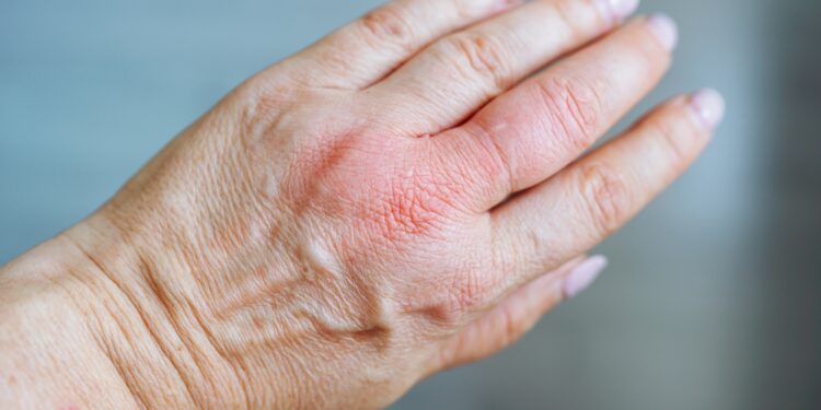 Patinusios rankos rytais