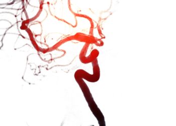 Kodėl mano išmatose yra kraujo krešulių?