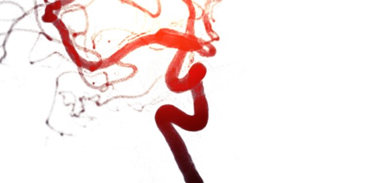 Kodėl mano išmatose yra kraujo krešulių?