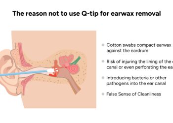 CPAP aparatų valymo įrenginiai: ar juos saugu naudoti?