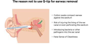CPAP aparatų valymo įrenginiai: ar juos saugu naudoti?