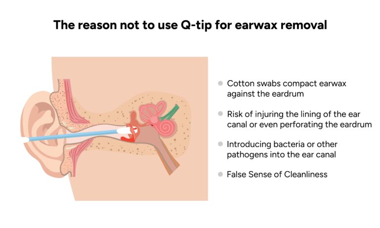 CPAP aparatų valymo įrenginiai: ar juos saugu naudoti?