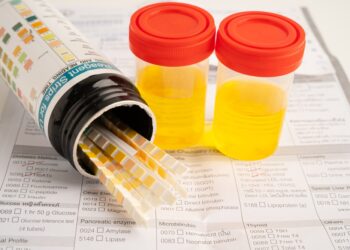 Švariai surinkto šlapimo mėginio pasėlis ir tyrimas