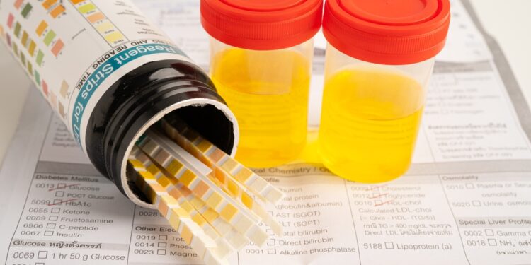 Švariai surinkto šlapimo mėginio pasėlis ir tyrimas