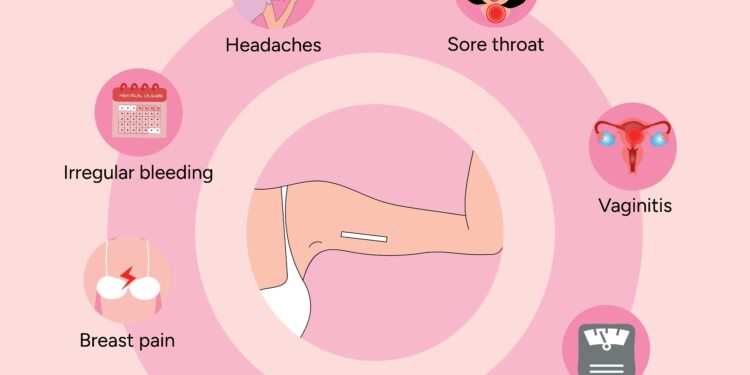 Ar kontraceptinės implantai sukelia svorio priaugimą?