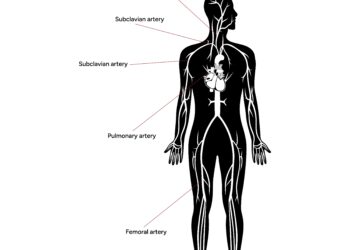 Brachialinis neuritas: skausmas, kurio nereikėtų ignoruoti
