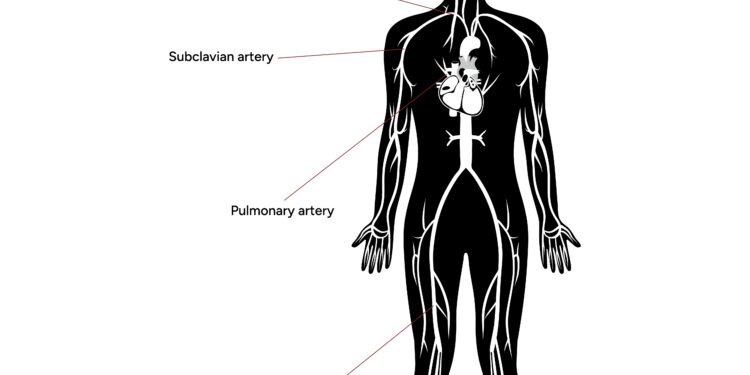 Brachialinis neuritas: skausmas, kurio nereikėtų ignoruoti