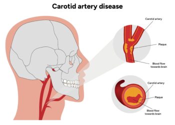 Krūtinės ir žandikaulio skausmas: ar tai širdies priepuolis?