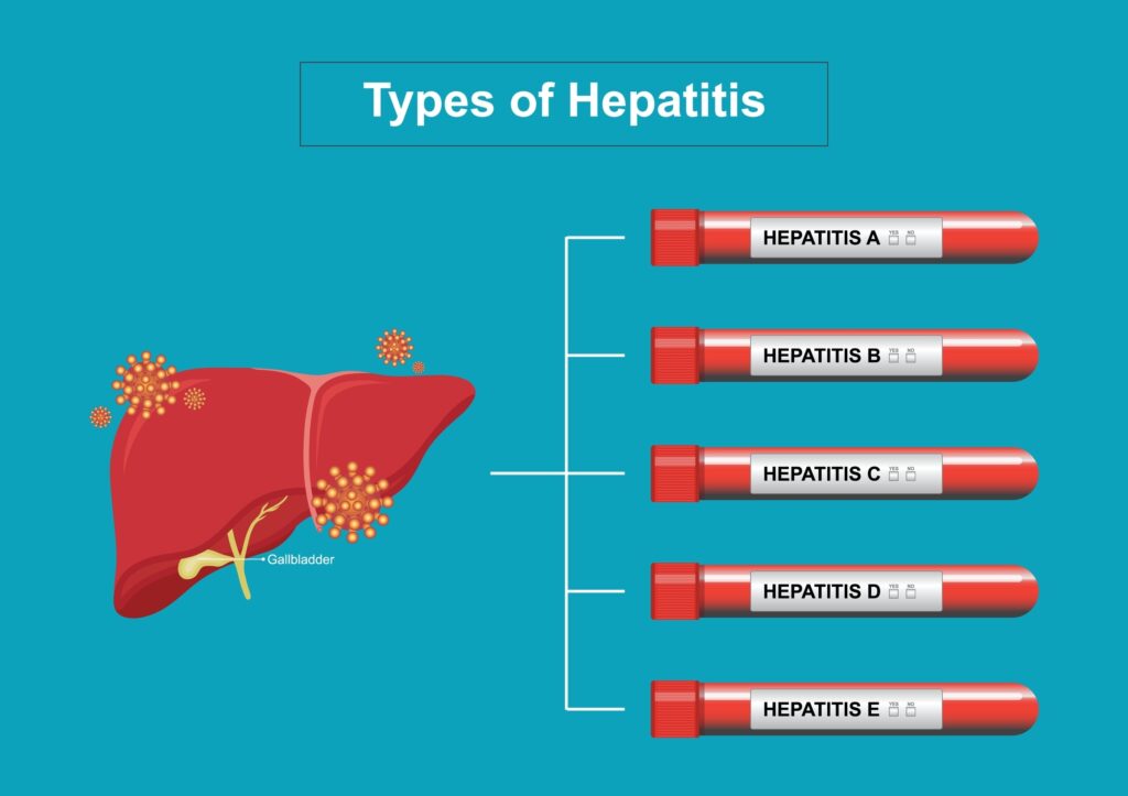 C hepatitas ir kraujo plazmos donorystė: svarbiausia informacija