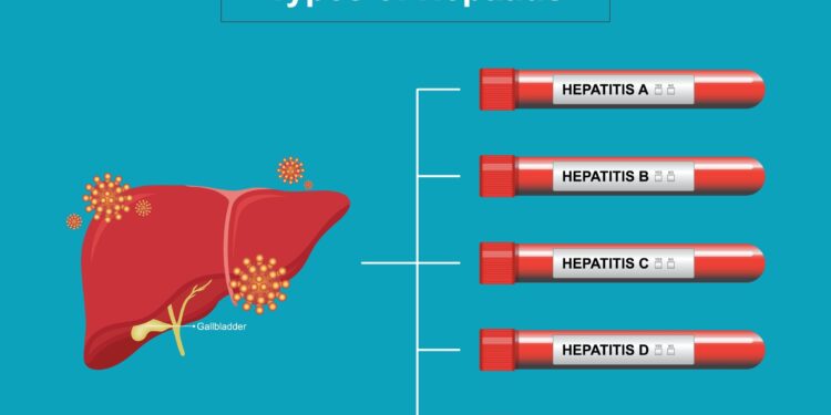 C hepatitas ir kraujo plazmos donorystė: svarbiausia informacija