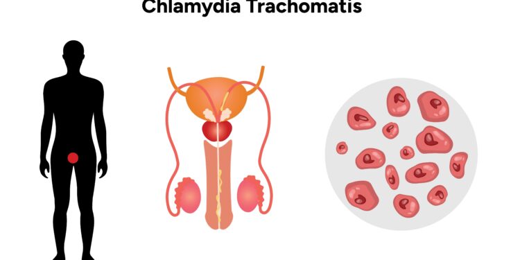Viskas, ką reikia žinoti apie vyrų šlaplės išskyrų tyrimus
