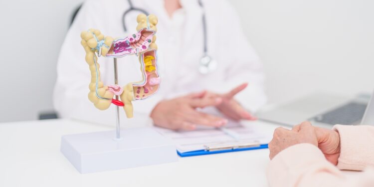 Opinis kolitas: viena diena su liga