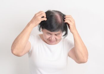 Ar pleiskanos užkrečiamos? Ir kiti svarbūs klausimai apie erzinančias galvos odos pleiskanas