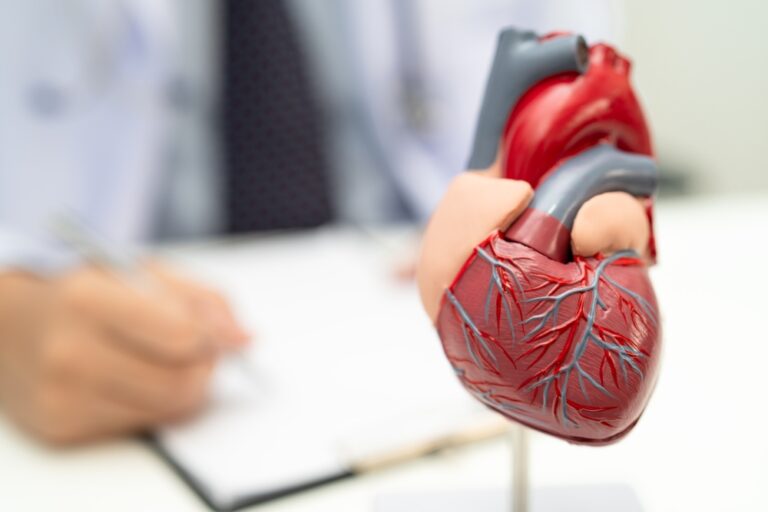 Angioplastika po infarkto: rizika ir nauda