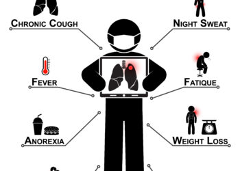 4 priežastys, kodėl vatos kamuoliukų dieta gali būti mirtina