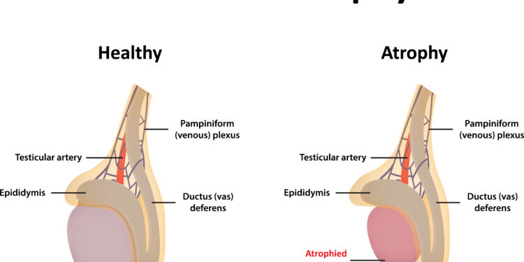 Perdėtai aktyvios šlapimo pūslės diagnostika