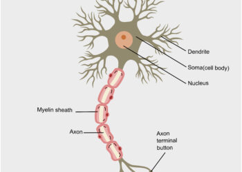 Viskas, ką reikia žinoti apie perkaitimą ir išsėtinę sklerozę (Ufthofo fenomenas)