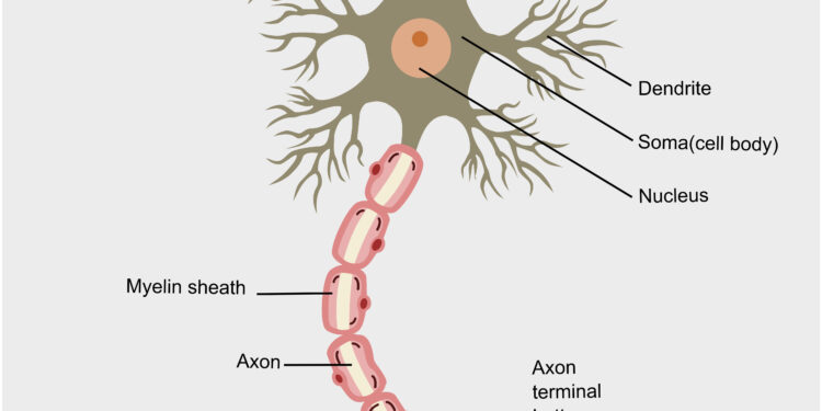 Viskas, ką reikia žinoti apie perkaitimą ir išsėtinę sklerozę (Ufthofo fenomenas)