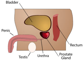 Ūminė inkstų kanalėlių nekrozė