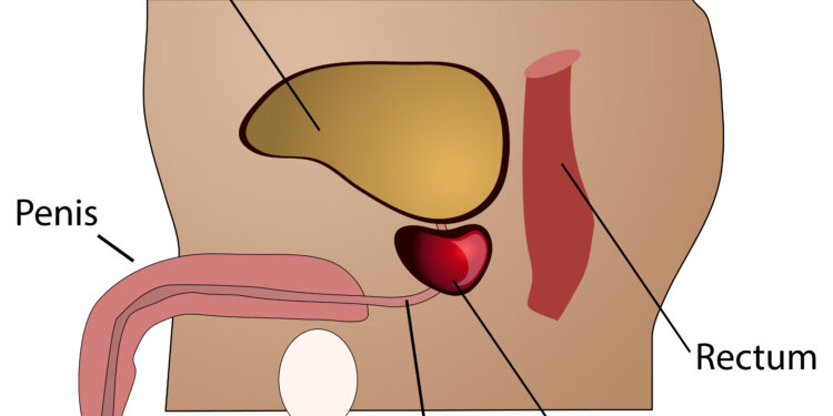 Ūminė inkstų kanalėlių nekrozė