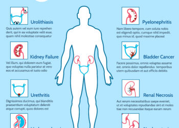 Nuolat norisi šlapintis, bet nieko neišeina