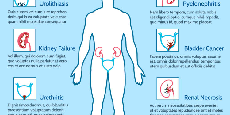 Nuolat norisi šlapintis, bet nieko neišeina