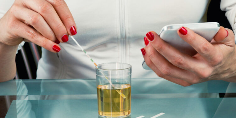 Šlapimo koncentracijos tyrimas