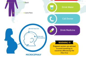 Ar sveika žarnyno veikla gali padėti suvaldyti nerimą?