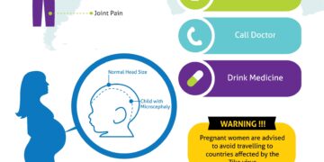 Ar sveika žarnyno veikla gali padėti suvaldyti nerimą?
