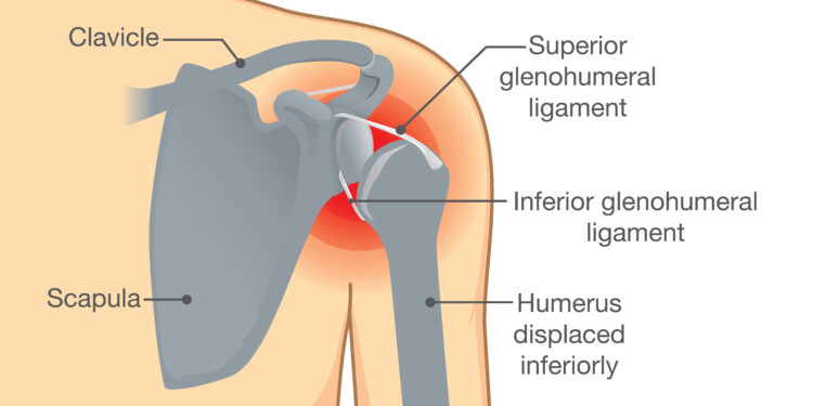 Didžiausiojo iškvėpimo tėkmės greitis