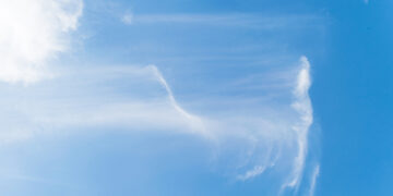 Osteoartrito priežastys ir rizikos veiksniai