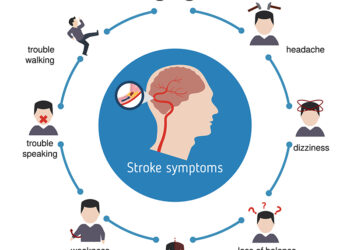 Mild Cognitive Impairment (MCI) lietuviškai įprastai verčiamas taip:Lengvas kognityvinis sutrikimas