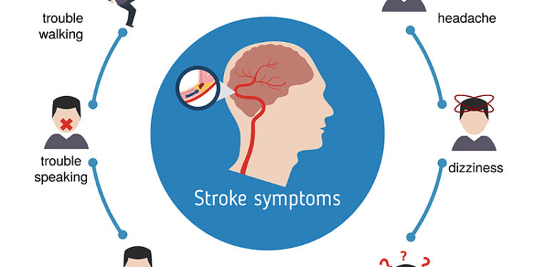 Mild Cognitive Impairment (MCI) lietuviškai įprastai verčiamas taip:Lengvas kognityvinis sutrikimas