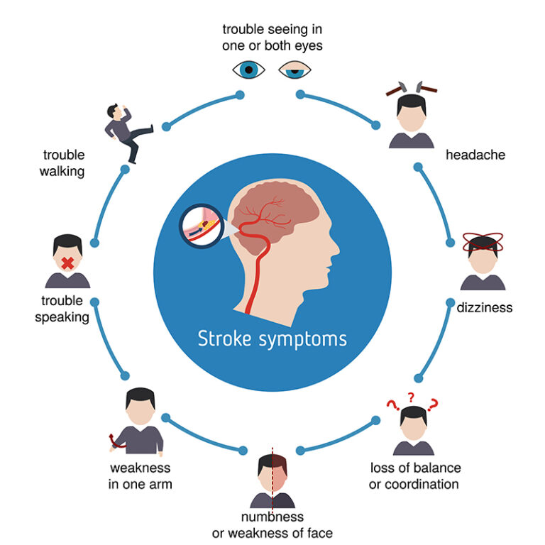 Mild Cognitive Impairment (MCI) lietuviškai įprastai verčiamas taip:Lengvas kognityvinis sutrikimas