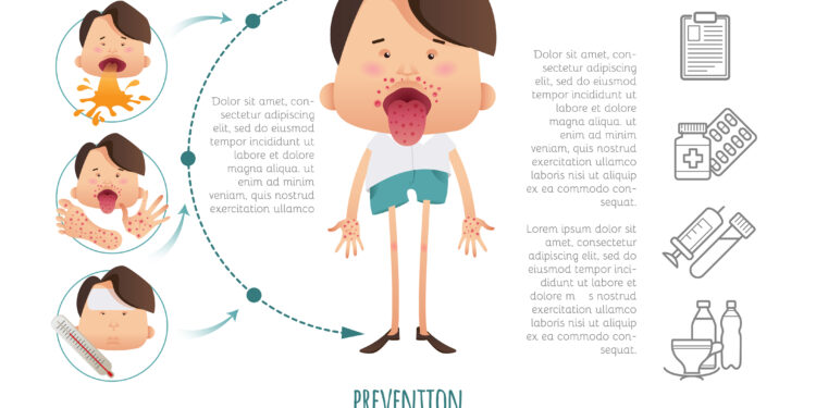 Kaip įveikiu FOMO, kai paūmėja Krono liga