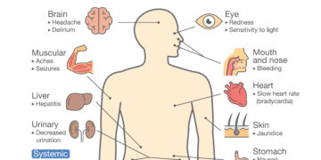 Ką reiškia turėti pageltusias ar nepageltusias akių obuolių baltymas