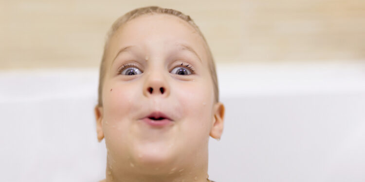 Pellagra lietuviškai būtų „Pelagra“. Tai yra medicininis terminas, kuris dažniausiai nevartojamas pažodžiui išverstas, o tiesiog adaptuojamas lietuviškai pagal tarimą. Savaime suprantama, jei reikia, galima pridėti paaiškinimą: „Pelagra (niacino trūkumo liga)“. Tačiau kaip medicininis pavadinimas – „Pelagra“.