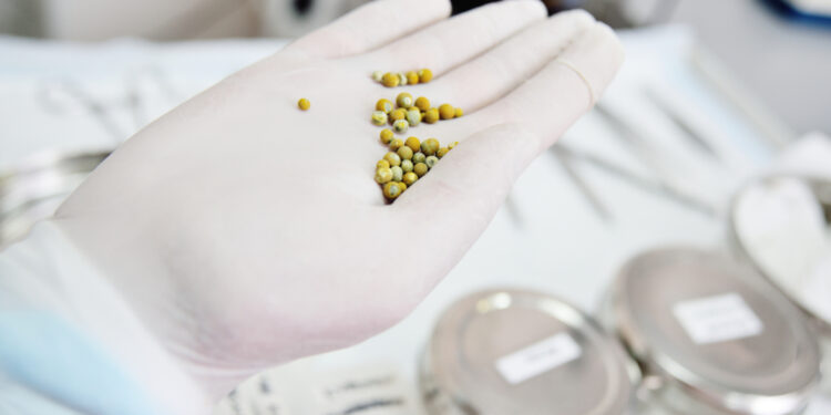 Viskas, ką norite sužinoti apie tulžies rūgščių druskas